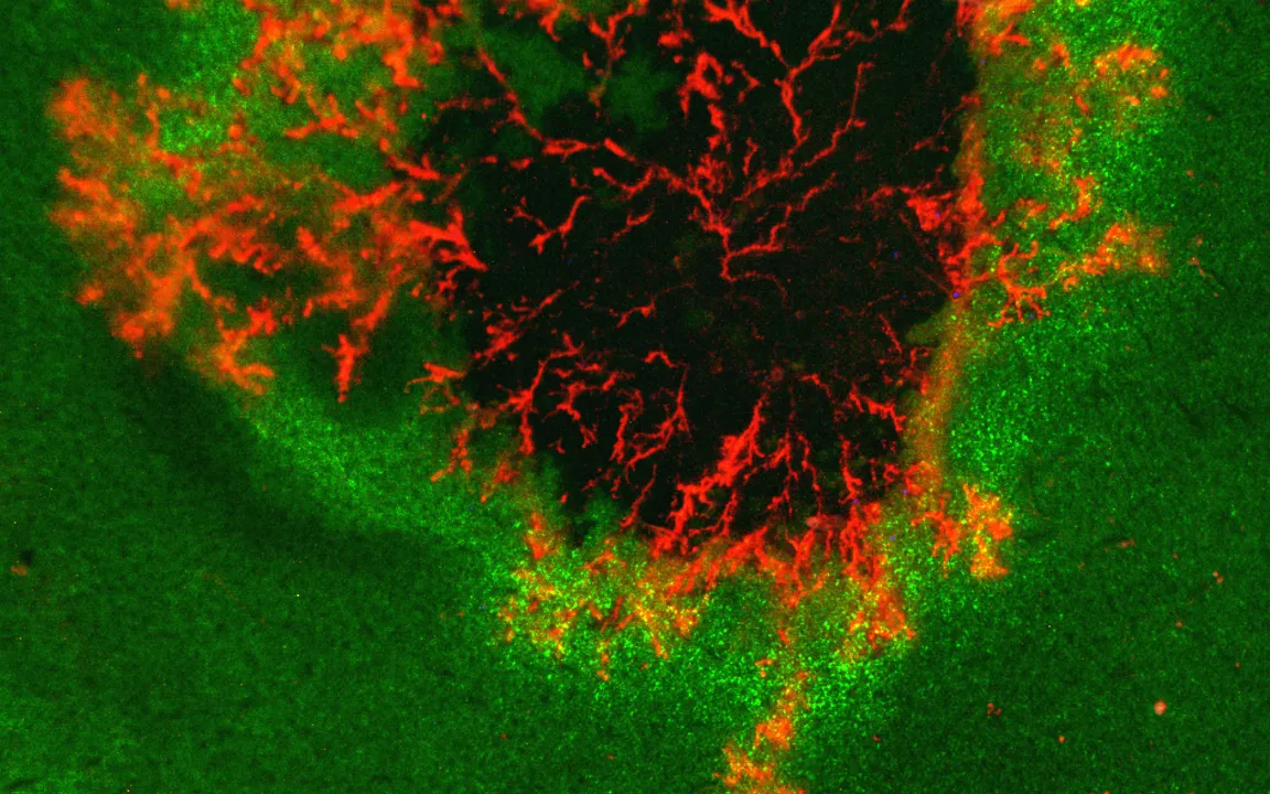 Phytophthora: Kartoffeln mit den richtigen Antennen